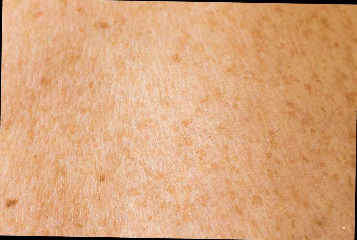 젠틀맥스 프로 플러스, 남자 제모에 왜 좋을까?